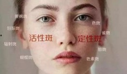 活斑最新爆料,揭秘神秘事件背后的惊人真相