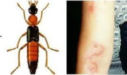 昆虫学者皮肤最新爆料蓝皮,蓝皮昆虫的神秘生成之谜